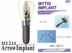 マイティスアローインプラント