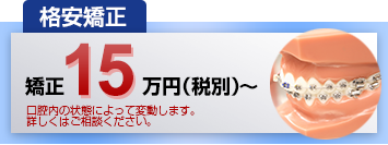 格安矯正15万円（税別）～：口腔内の状態によって変動します。詳しくはご相談ください。