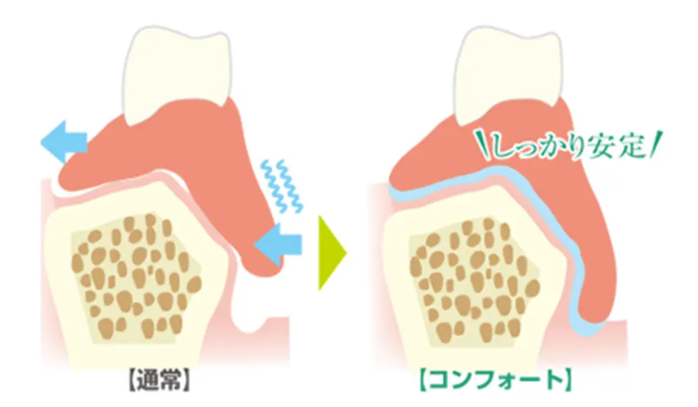 お口の中でがっちり固定 安定して外れにくい
