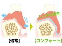 コンフォート