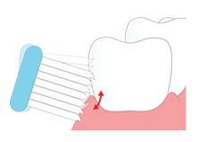 力を入れすぎると、歯茎を傷つけてしまいます。軽い力で磨くと効率的です。