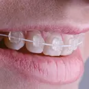 矯正歯科