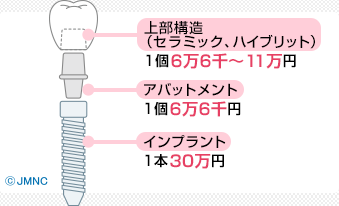 品質・審美性重視プラン