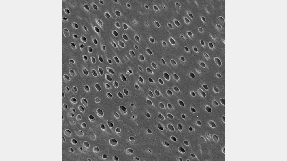 3%EDTA を併用した超音波洗浄