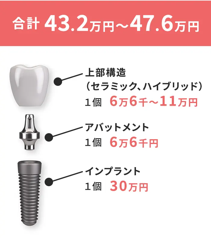 インプラント