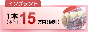 インプラント1本（本体）15万円（税別）