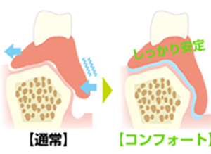 コンフォート