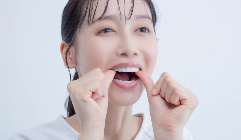 上の歯も同様に貼る